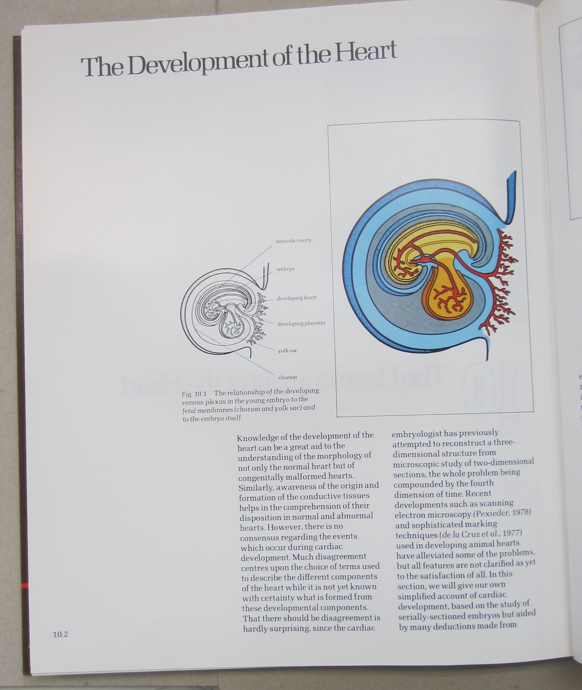Cardiac anatomy: An integrated text and colour atlas | Robert Henry ...